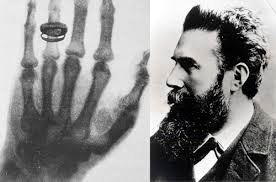 뢴트겐, X-ray 발견, 노벨물리학상(1901년)